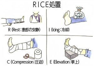 スポーツ障害 肉離れを早く治す方法と対策 うら Note スポーツ障害 肉離れを早く治す方法と対策 うら Note