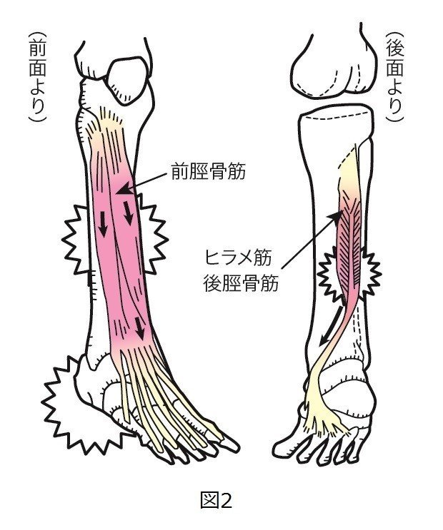 マラソンランナーに多いシンスプリント すねの内側や内くるぶし周辺の痛み こんどう接骨院 Note マラソンランナーに多いシンスプリント すねの内側や内くるぶし周辺の痛み こんどう接骨院 Note