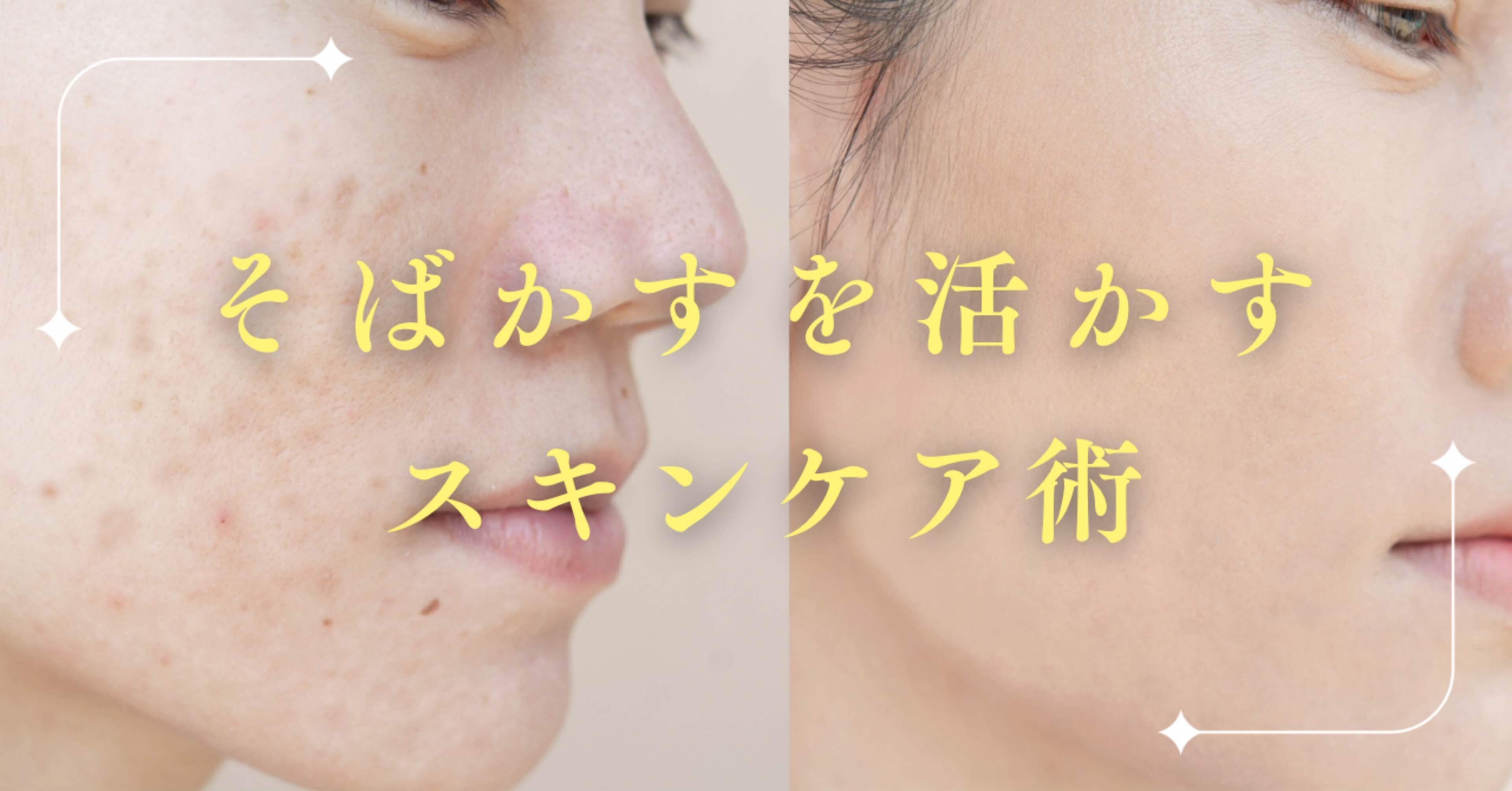 自分の肌をもっと好きに♪》そばかすを活かすスキンケア術｜ちぃ