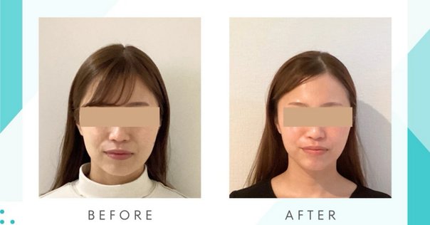 COREFITのFACE POINTER 2使用感想レビュー｜山崎響