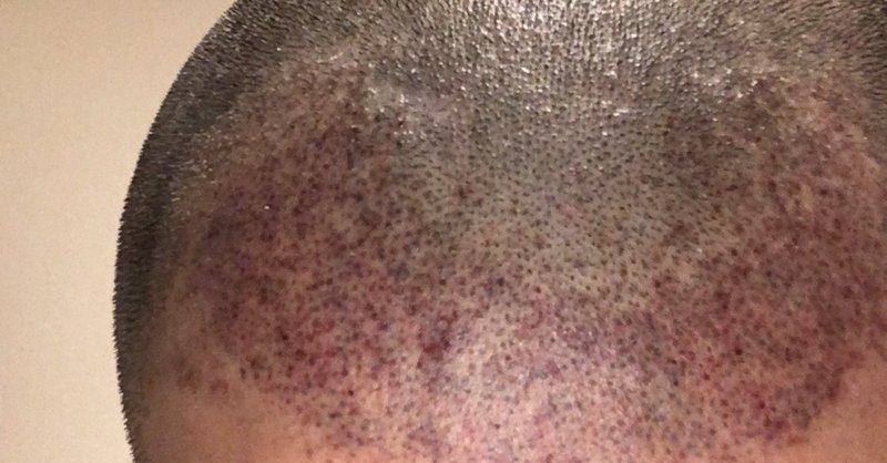 ヘアタトゥー の新着タグ記事一覧 Note つくる つながる とどける