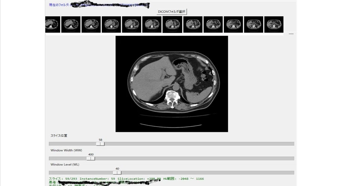 Python DICOM Viewer with Thumbnails [Complete Code Included]｜シェル君