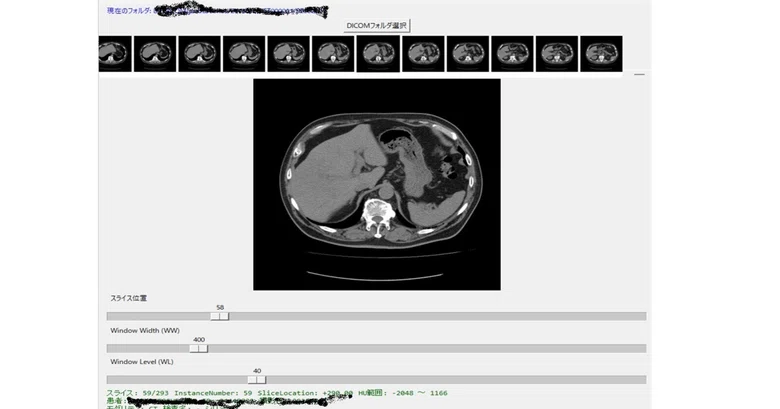 Python DICOM Viewer with Thumbnails [Complete Code Included]｜シェル君