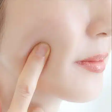 美肌ちゃん