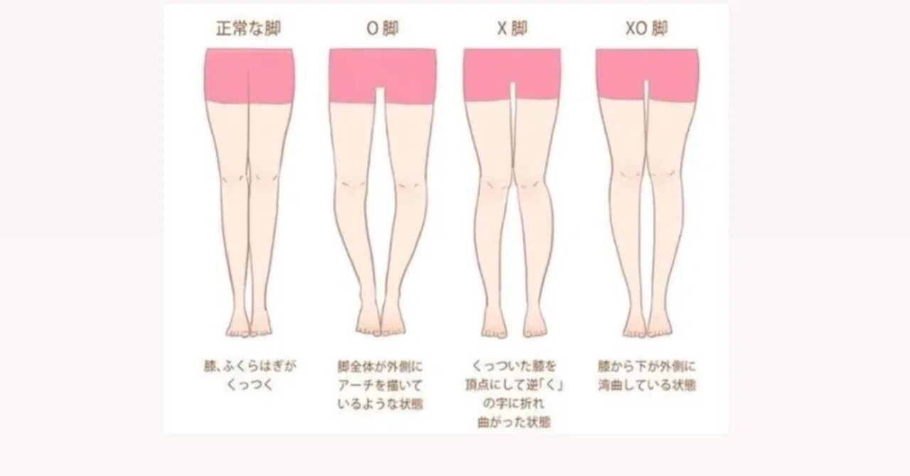 X脚・O脚・XO脚の原因と解決策｜姿勢の歪みを整えて、脚ライン美人に！｜伊丹パーソナルトレーナー海生