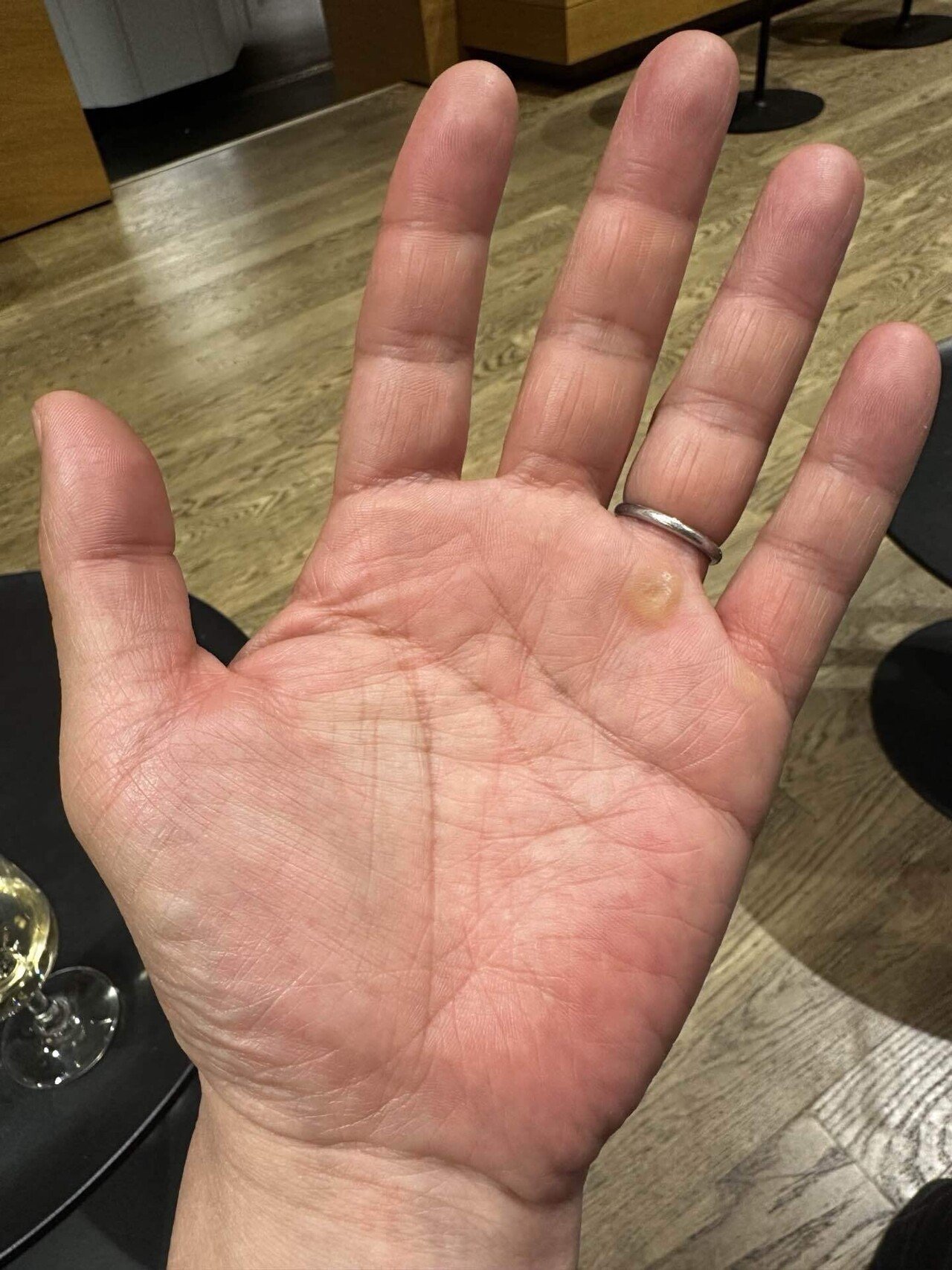 見れるのは手相だけではない : 画像を観る力①｜Daisuke Sawai : Dai33