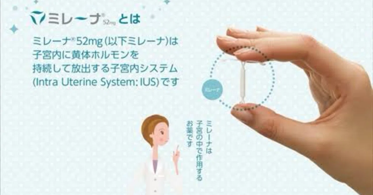 [Experience Report] My Mirena insertion experience, follow-up stories ...