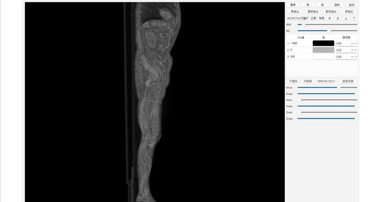 【有料記事】第5回Pythonで始めるDICOM 3D表示｜シェル君