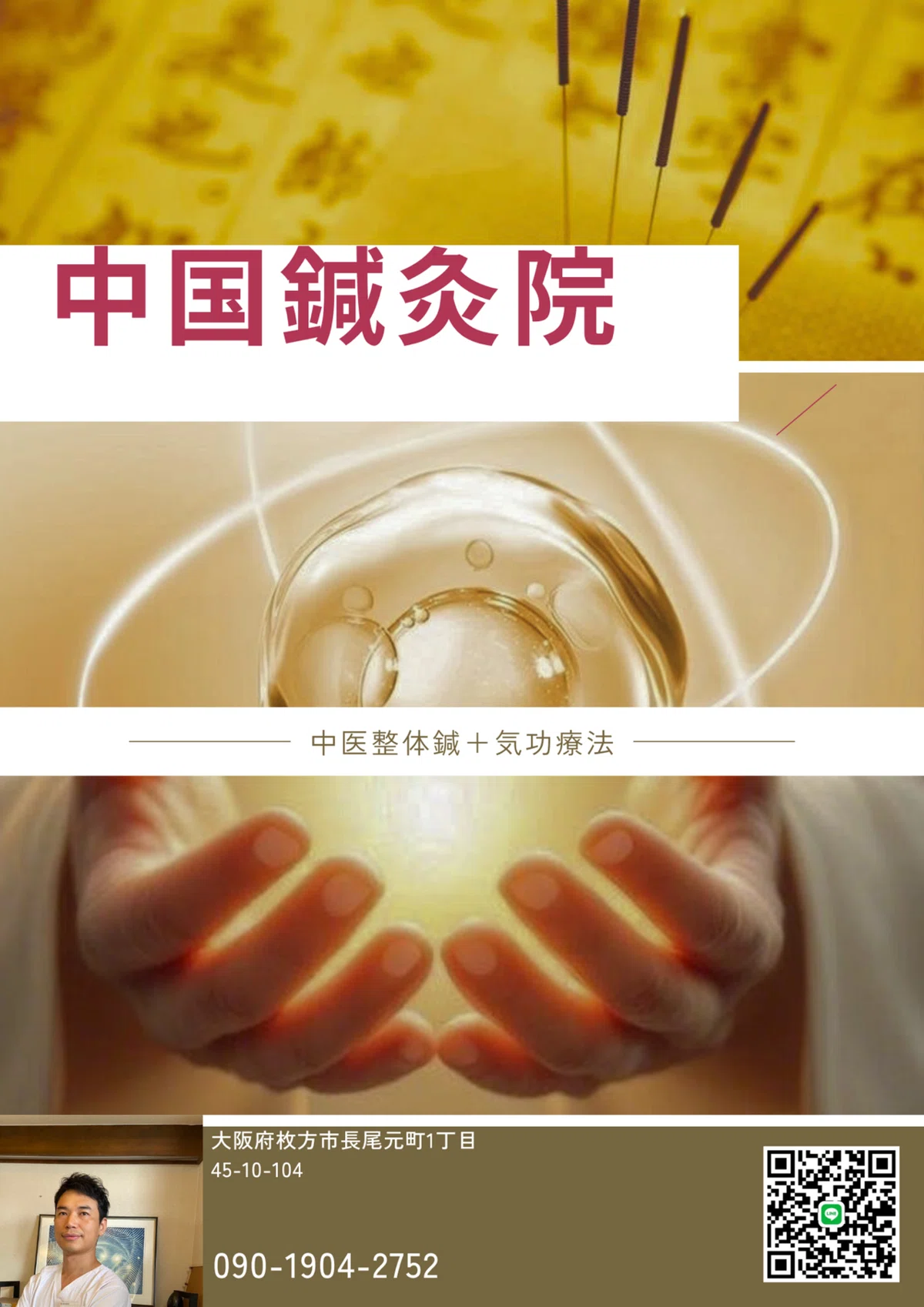 【驚きの体験談多数】頭の鍼で視界がクリアに！メンタルもスッキリ！中国鍼灸院 大阪｜中国鍼灸院 枚方市