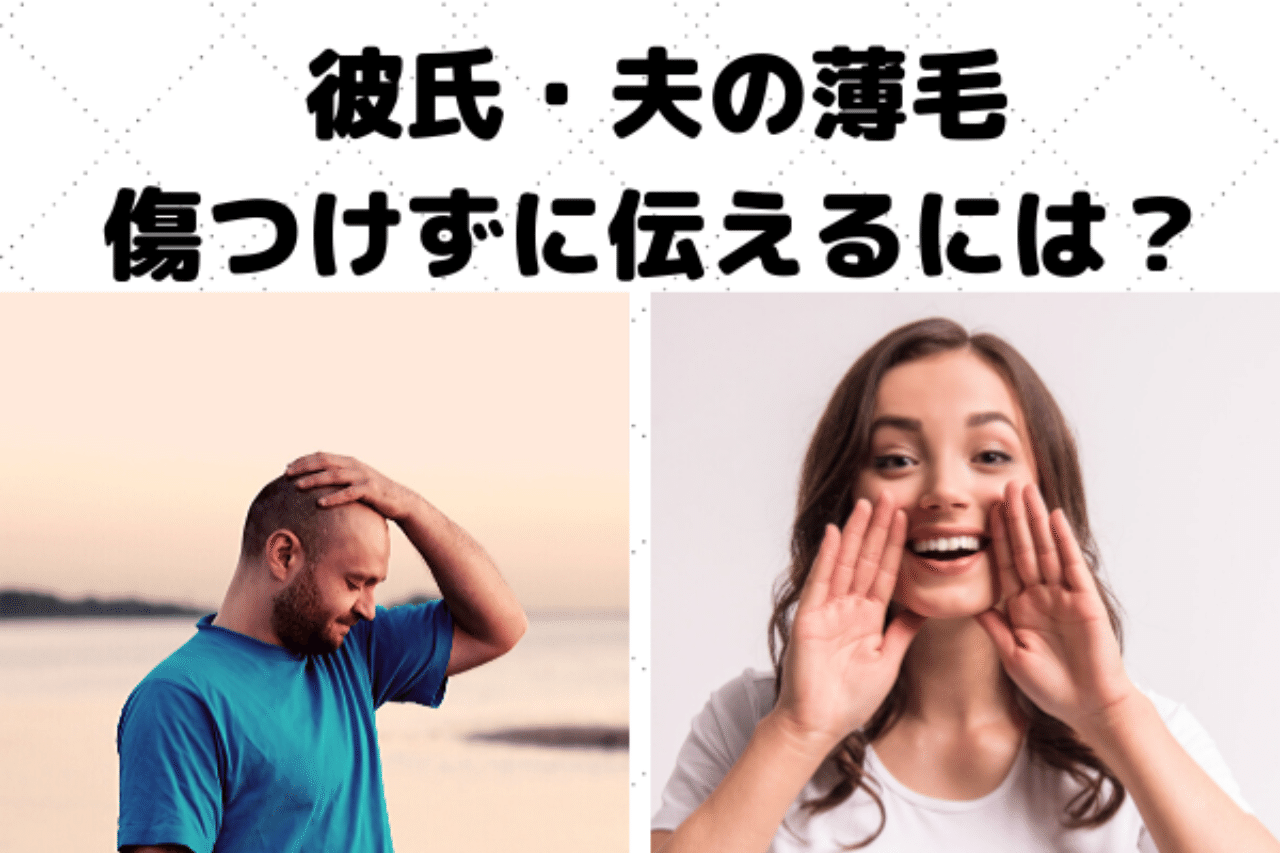 彼氏 夫がハゲてきたらどうしたらいい パートナーを傷つけない伝え方 はえぎわ Note