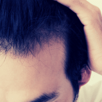 彼氏 夫がハゲてきたらどうしたらいい パートナーを傷つけない伝え方 はえぎわ Note