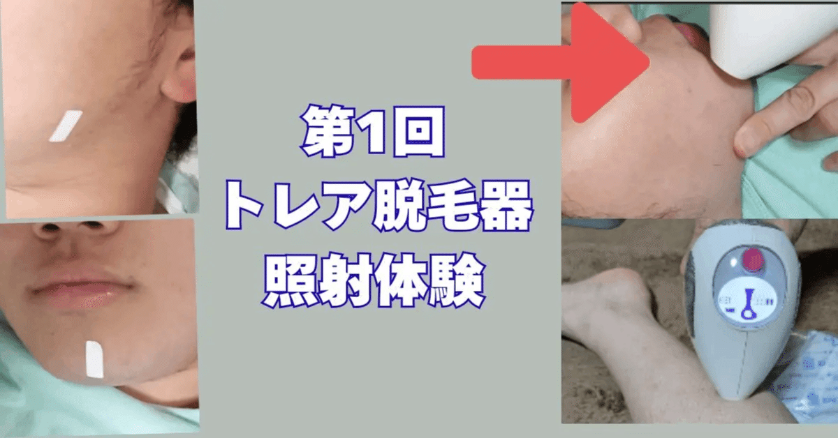 ついに新品のトリア脱毛器4X🔫購入しました🎉🛒🎉｜左官屋おやじブログ