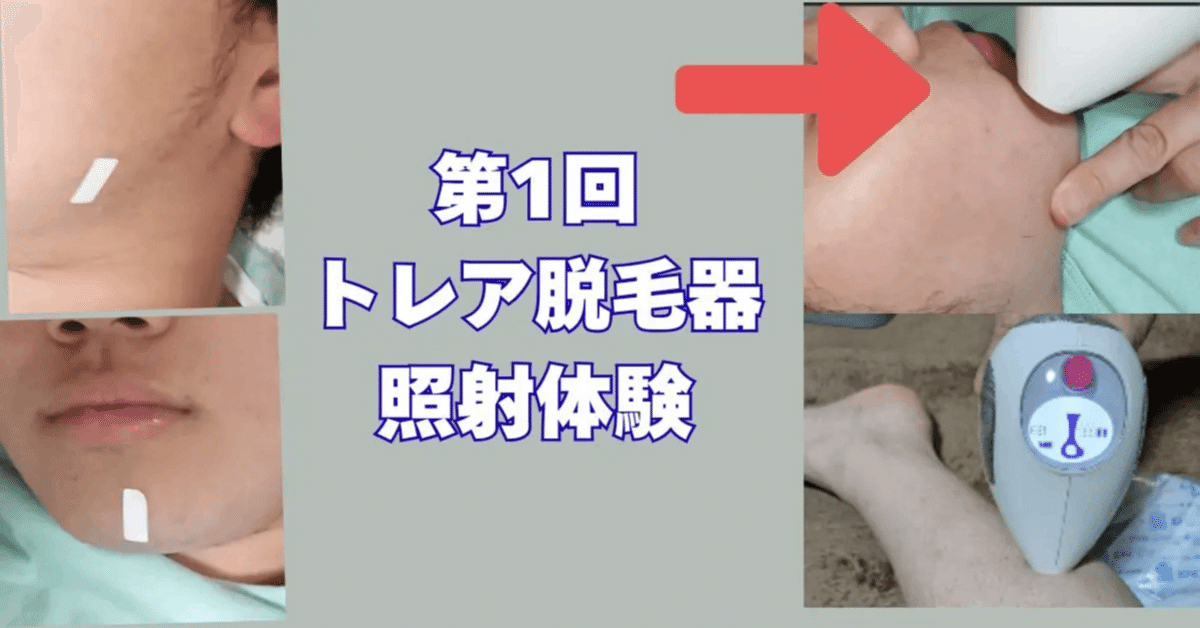 ついに新品のトリア脱毛器4X🔫購入しました🎉🛒🎉｜左官屋