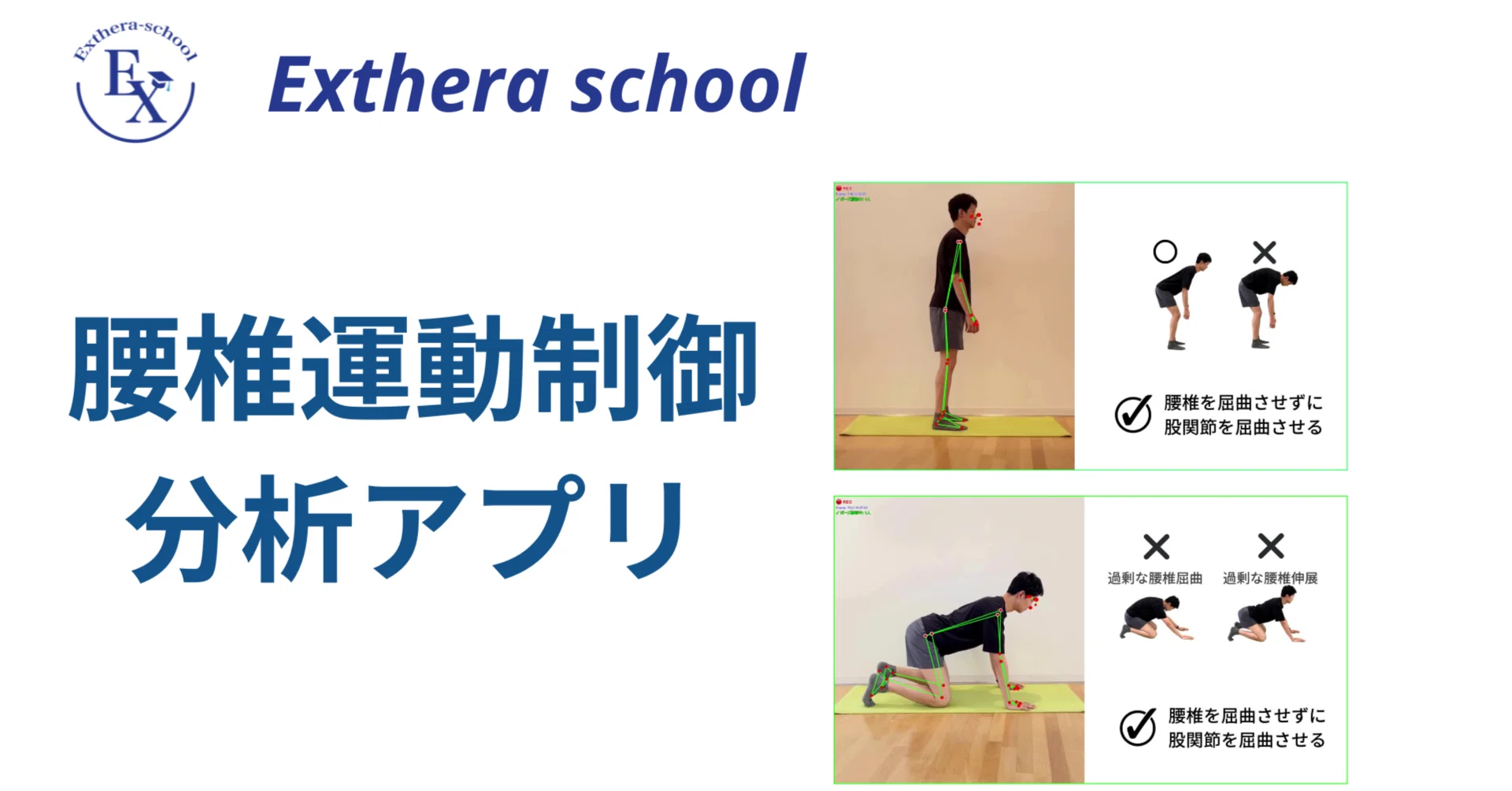 腰椎モーターコントロールを “見える化” する時代へ｜小林龍樹＠理学療法士