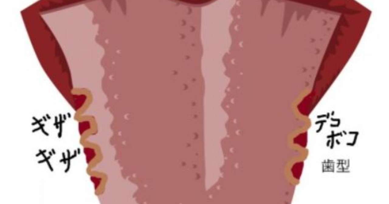 舌のふちがデコボコで治らないと ストレスがたまりませんか Uebayashi Note