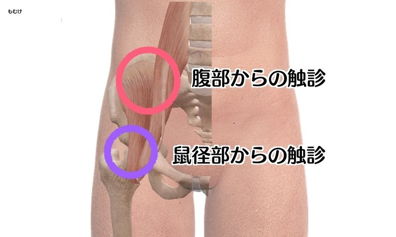 臨床で使える腸腰筋 腸骨筋 大腰筋 の知識 森元塾 国家試験対策 Note