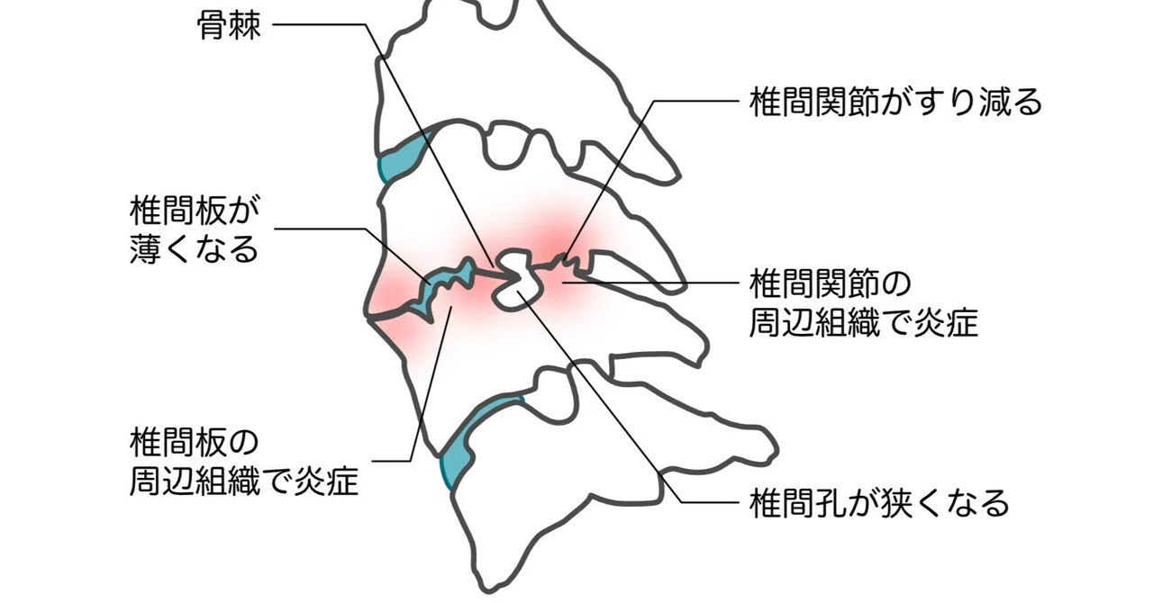 頚部痛、背部痛の触診|スポーツ鍼灸を極めたい鍼灸師 ATSU