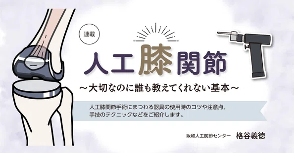 人工膝関節～大切なのに誰も教えてくれない基本～｜メジカルビュー社｜note
