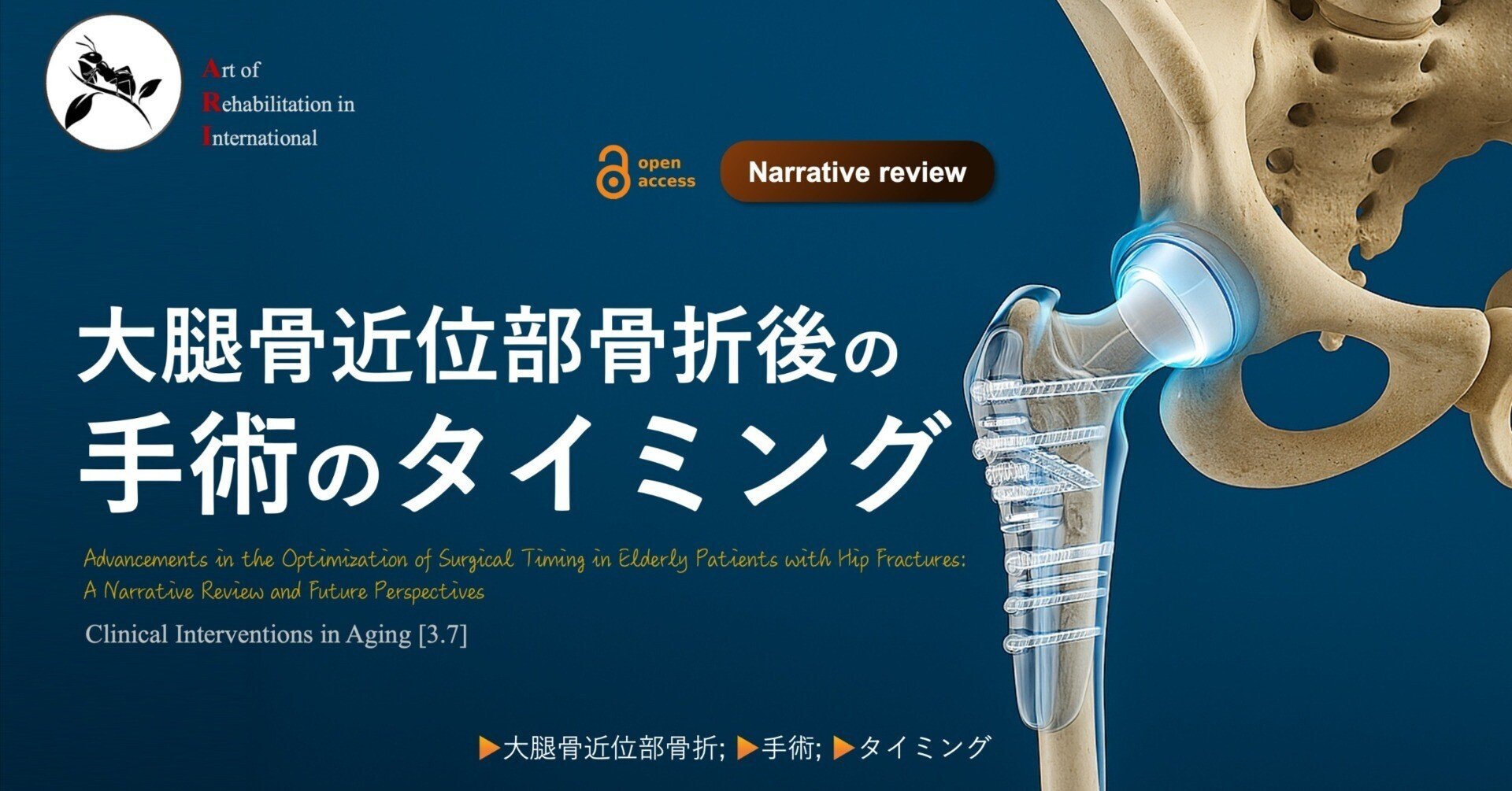 大腿骨近位部骨折 Osteosynthesis & Arthroplasty 大腿骨近位部骨折