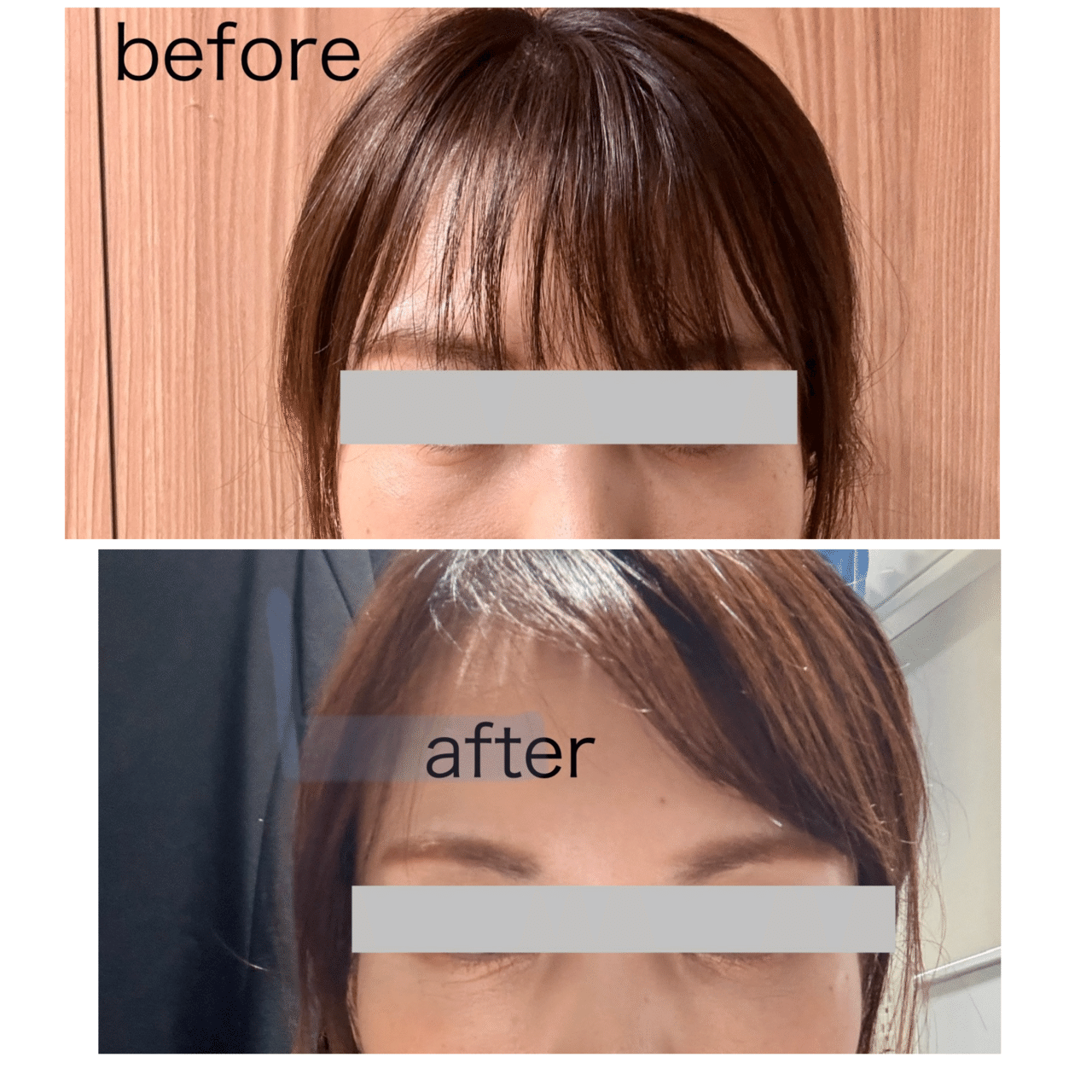 Emmo - Emmo added a new photo — at 𝐸𝑀𝑀𝑂 𝐹𝐴𝐶𝐸 𝐶𝐿𝐼𝑁𝐼𝐶  𝑜𝑚𝑖𝑦𝑎., image size:1280x1280