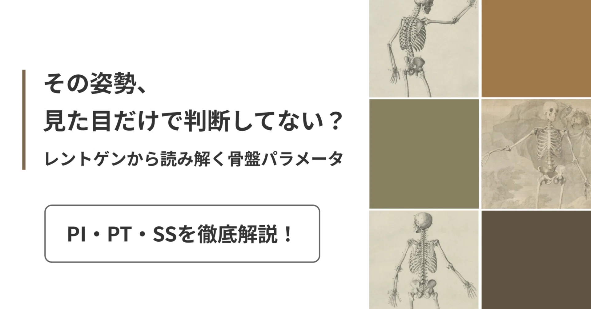その姿勢、見た目だけで判断してない？－レントゲンから読み解く骨盤