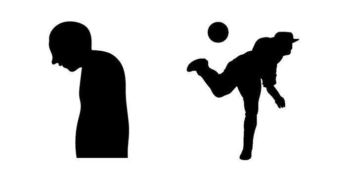 胸郭出口症候群のリハビリテーション たくみロドリゲス 運動器理学療法士 Note 胸郭出口症候群のリハビリテーション たくみロドリゲス 運動器理学療法士 Note