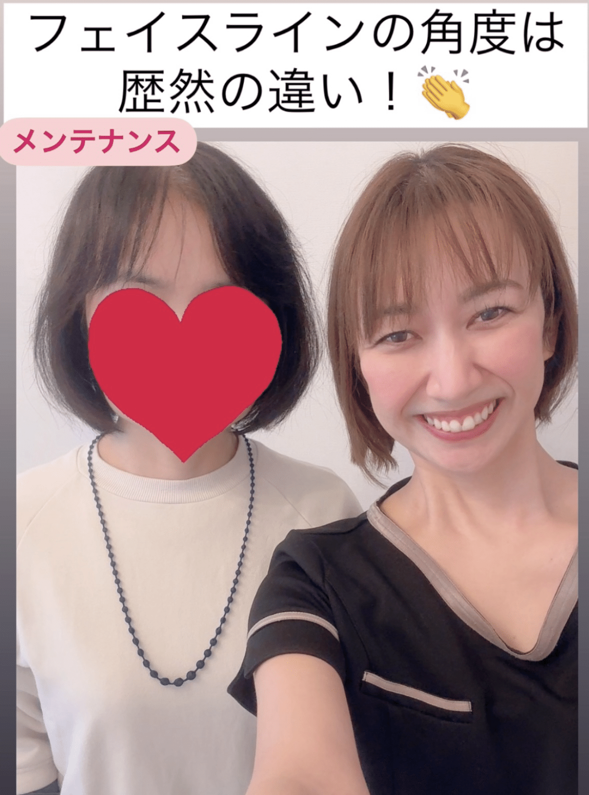 エラ削ってません。なのに骨も変わる？！【ビフォーアフター】｜エラ