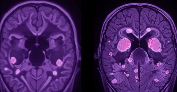 薬物動態研究におけるイメージング質量分析の活用｜Pharma
