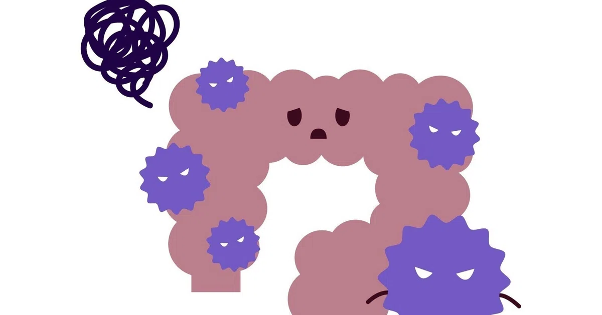Colon Dysfunction With 'I know IBD, please feel free to use it,' people with ...