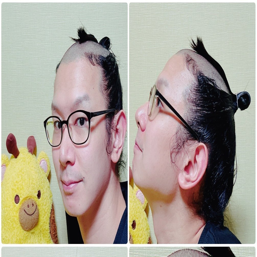 ＊ちょんまげ＊ 2025/07/29 地毛ちょんまげ録｜まげメガネ