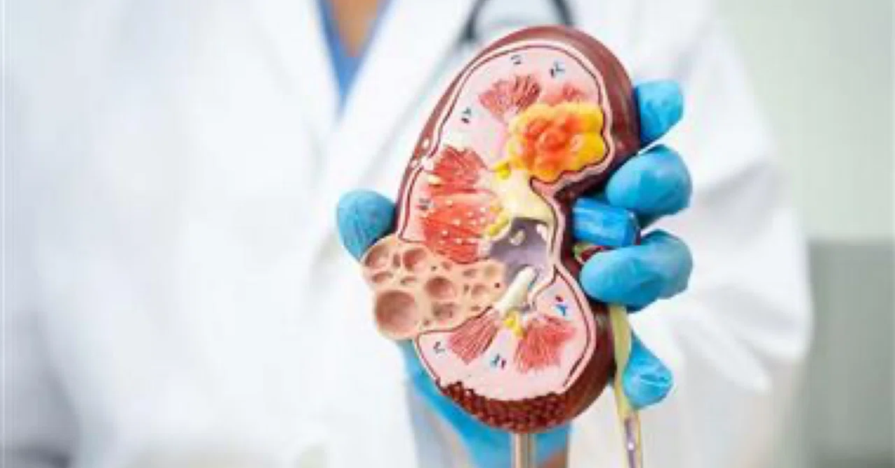 最新｜腎臓に害を及ぼす薬の種類