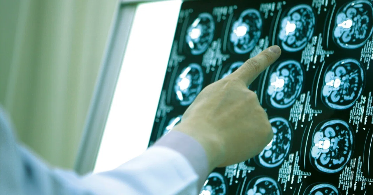 Newly Discovered 'Sixth Sense' Connects Gut Microbes to the Brain in ...