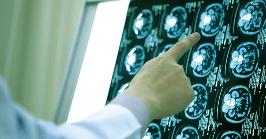 Newly Discovered 'Sixth Sense' Connects Gut Microbes to the Brain in ...
