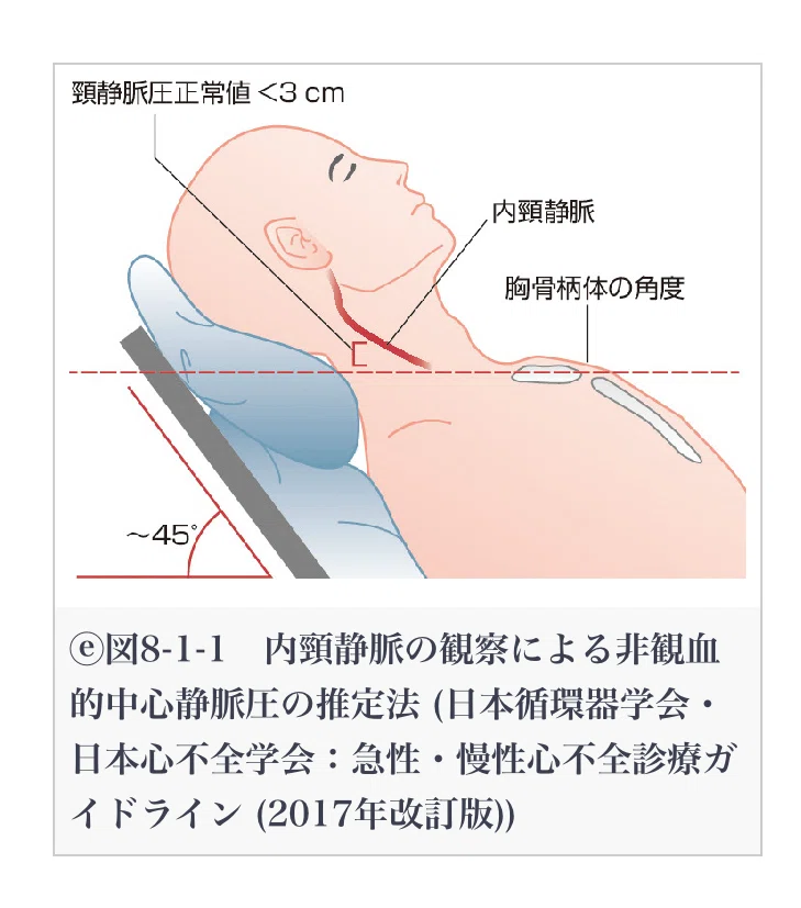 循環器疾患/診察について①｜心臓リハビリの学校@peyo