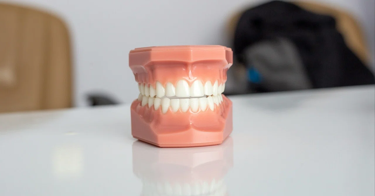 Trying Out Teeth Whitening at the Dentist (Part 2) - Monologues of a 30 ...