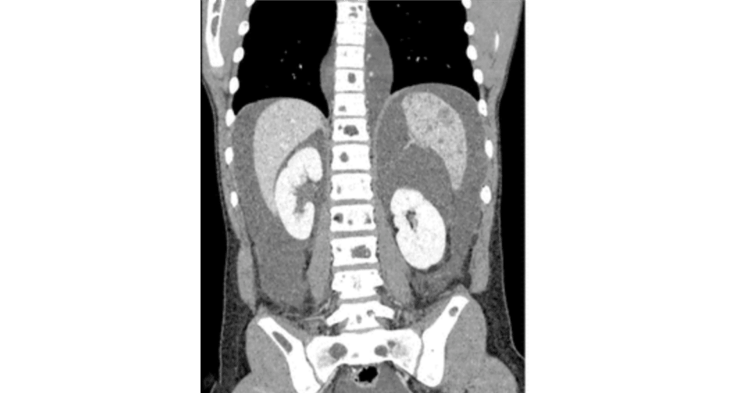 Case 311｜Toshihiro Furuta