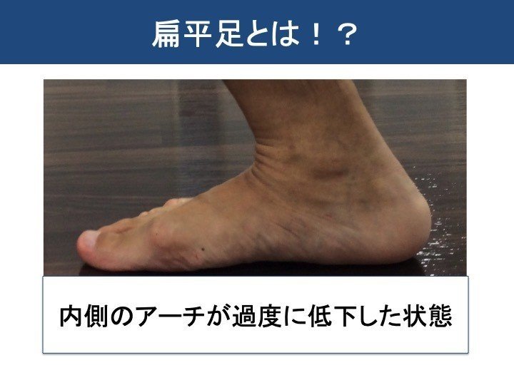 ハイアーチと扁平足の身体の傾向とセルフケア 岡野 良介 Note