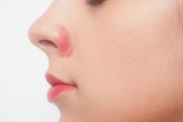 小鼻の赤みの原因とスキンケアでの改善方法 上手な隠し方 まめ Note