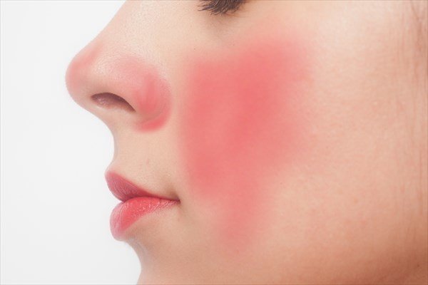 小鼻の赤みの原因とスキンケアでの改善方法 上手な隠し方 まめ Note 小鼻の赤みの原因とスキンケアでの改善方法 上手な隠し方 まめ Note