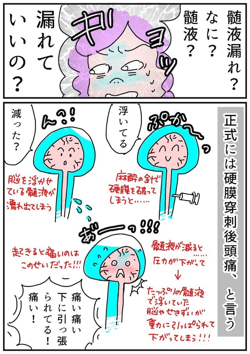 相棒は点滴棒 帝王切開と合併症のレポ漫画 みっぽんぽん Note 相棒は点滴棒 帝王切開と合併症のレポ漫画 みっぽんぽん Note