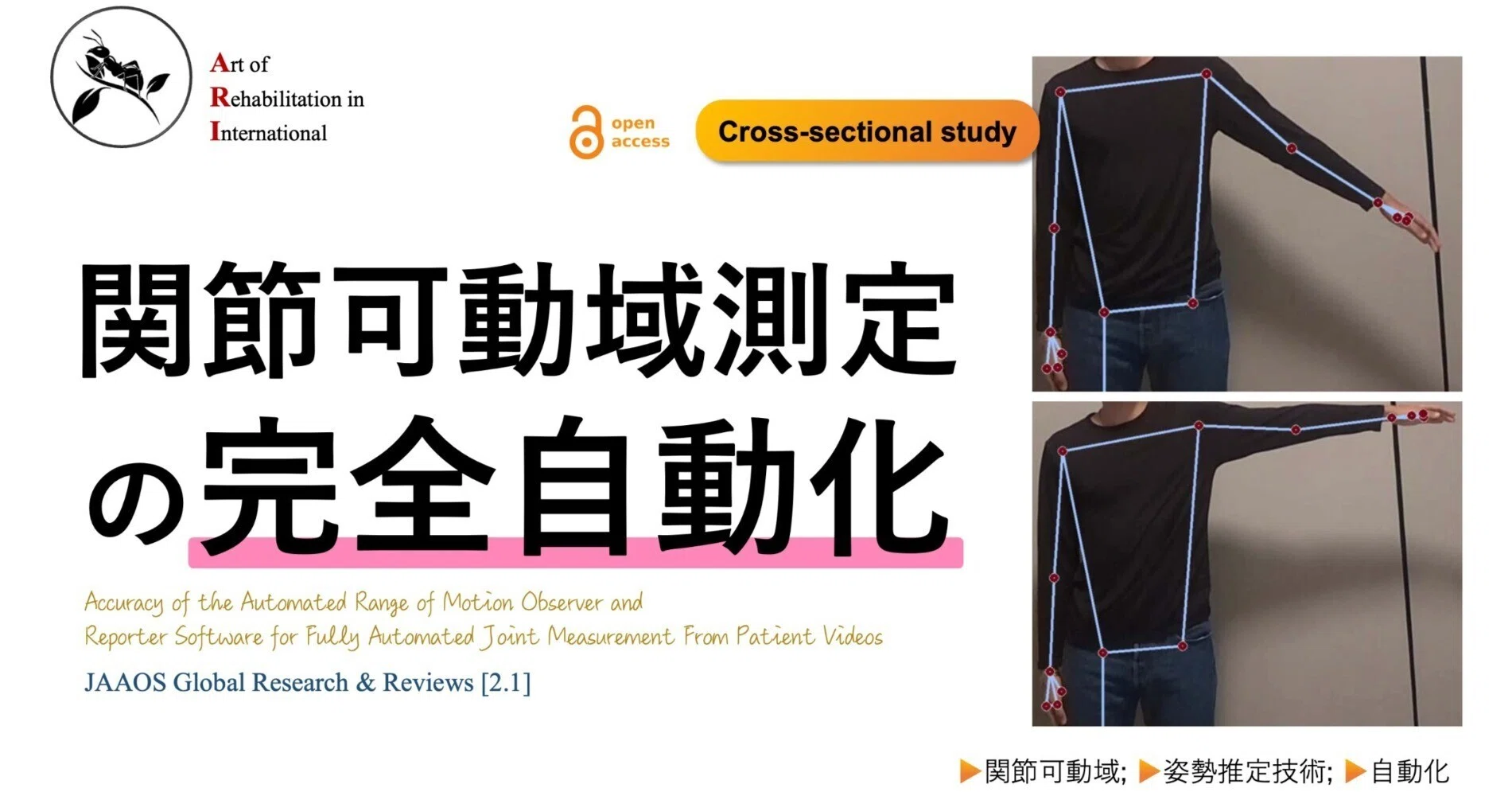 関節可動域測定の完全自動化｜Super Human | 理学療法士／保健学博士 Ph.D.