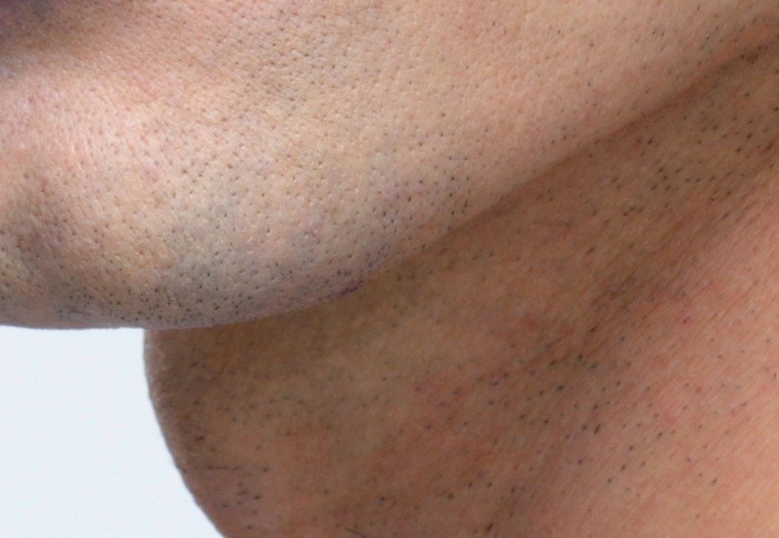 Photoshop 男の青ひげを退治せよ レタッチャー 大谷キミト Note Photoshop 男の青ひげを退治せよ レタッチャー 大谷キミト Note