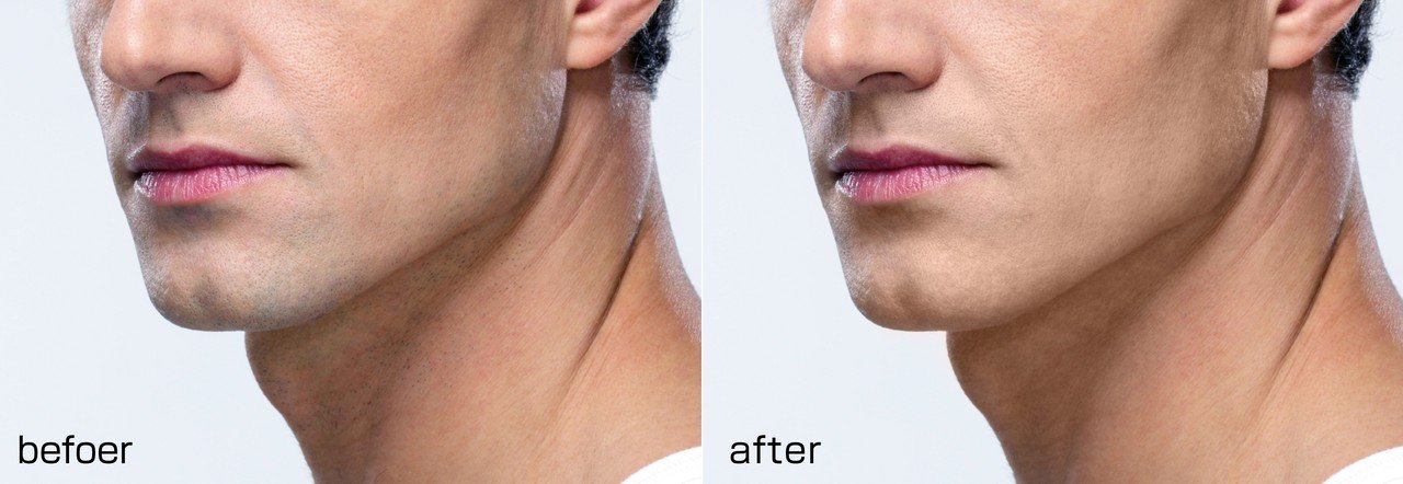 Photoshop 男の青ひげを退治せよ レタッチャー 大谷キミト Note Photoshop 男の青ひげを退治せよ レタッチャー 大谷キミト Note