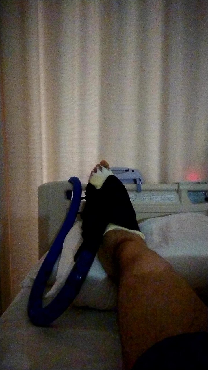 腓骨骨折入院 4 5日目 手術から術後経過について なべマガジン Note