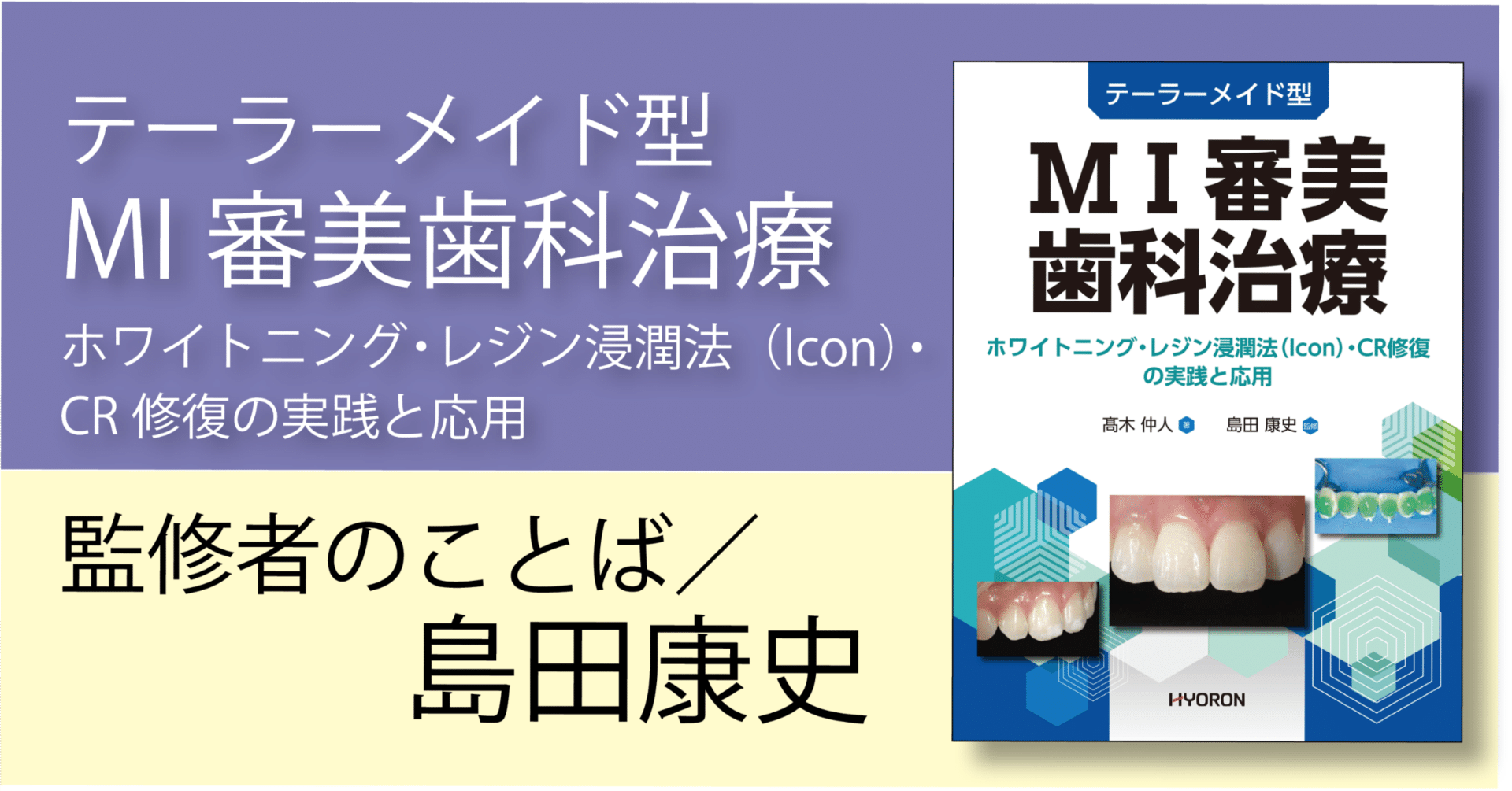 テーラーメード型MI審美歯科治療 テーラーメイド型 MI審美歯科治療―ホワイトニング・レジン浸潤法（Icon