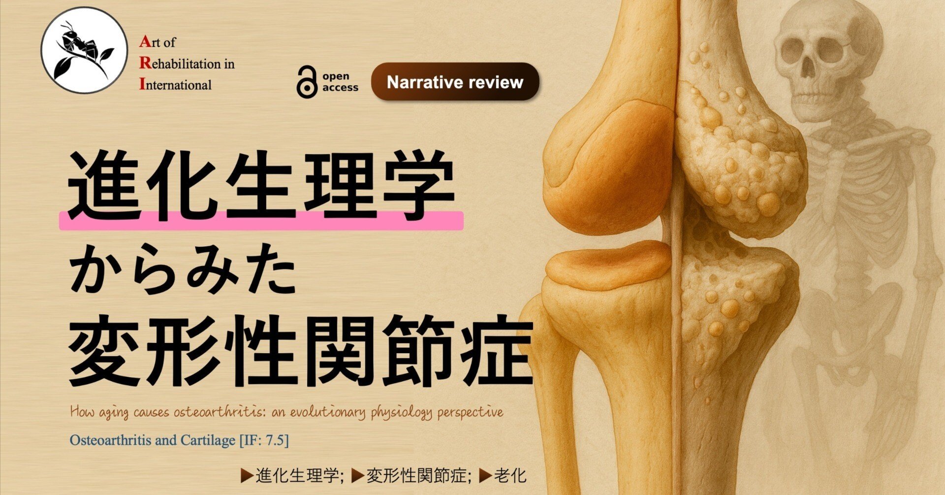進化生理学”からみた変形性関節症｜Super Human | 理学療法士