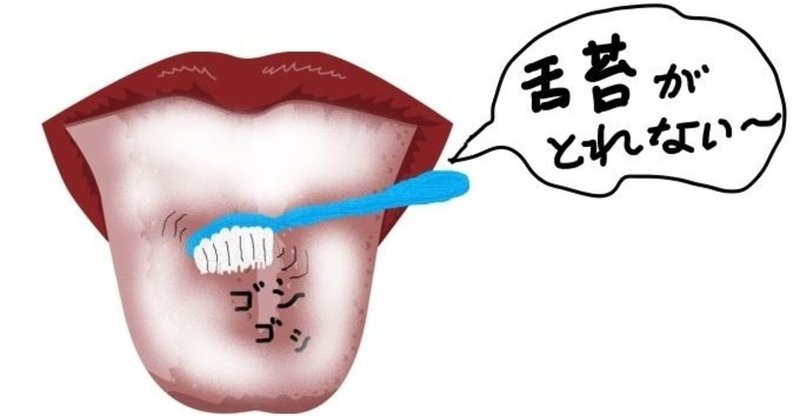 舌苔ケア用品のおすすめは uebayashi note