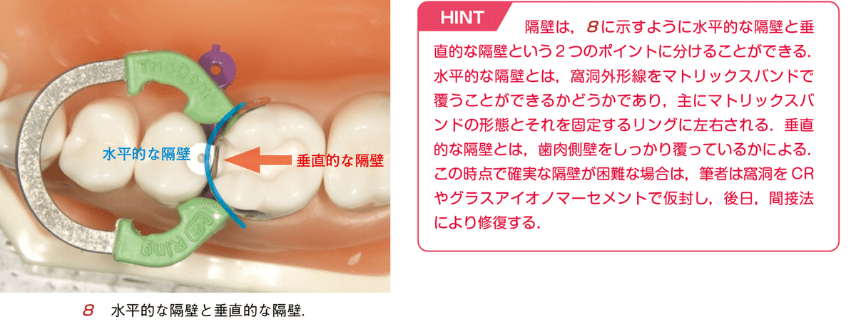 須崎 明・著『そうだったのか！ CR修復』より―やりたくないのに，やら