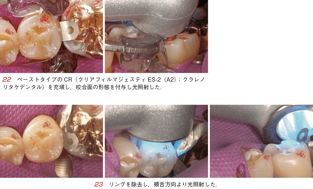 そうだったのか! CR修復 CR修復に悩んでいる人に読んでほしい本 そうだったのか！ CR修復［増補改訂版］ - 株式会社 ヒョーロン