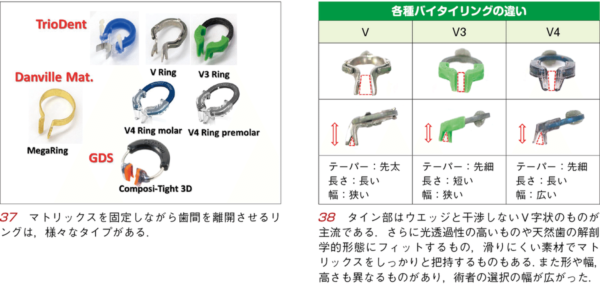 “失敗ゼロ\"のCR修復 シエン社 | “失敗ゼロ”のCR修復